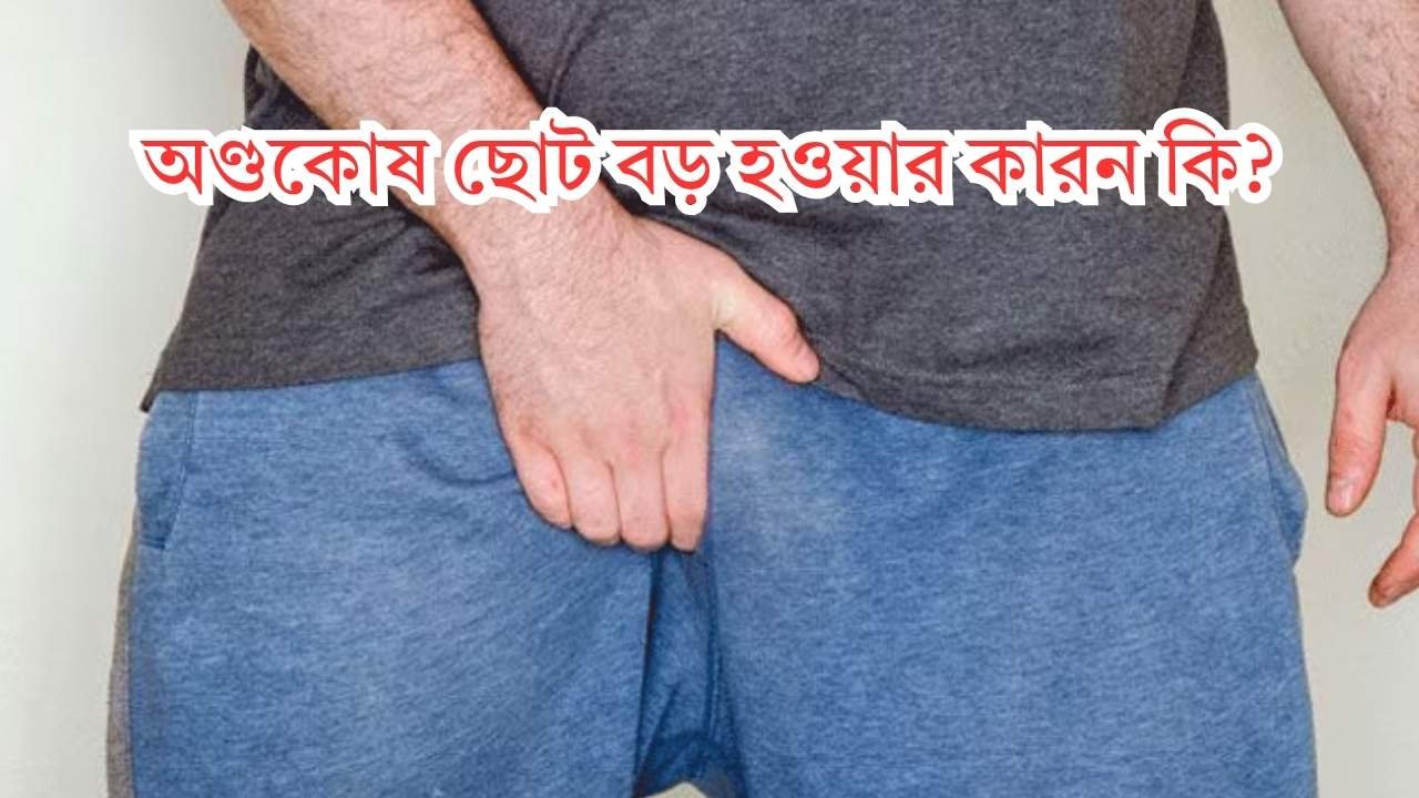 অণ্ডকোষ ছোট বড় হওয়ার কারন কি