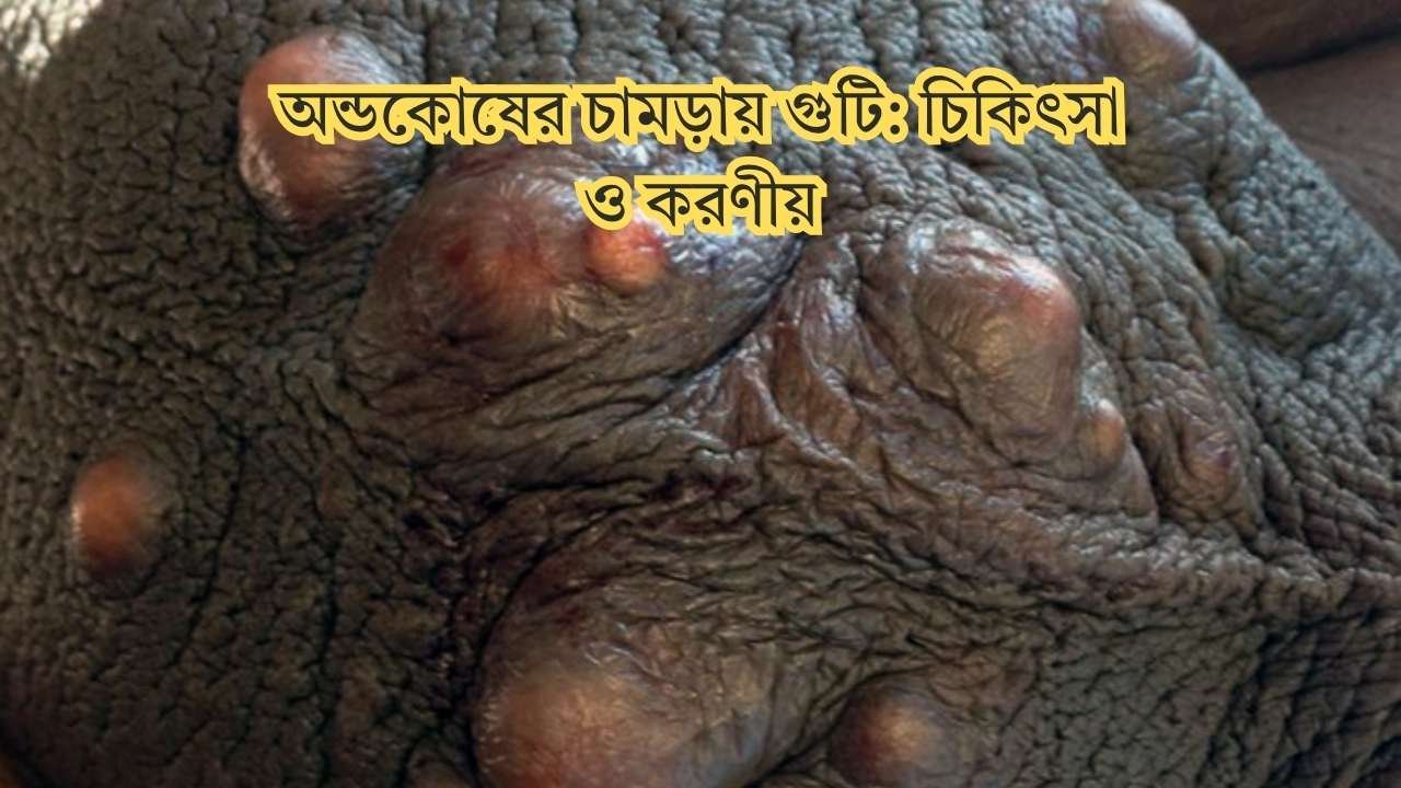 অন্ডকোষের চামড়ায় গুটি