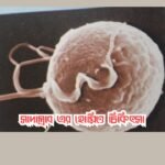 সাদাস্রাব এর হোমিও চিকিৎসা