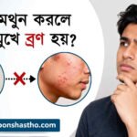 হস্তমৈথুন করলে কি মুখে ব্রণ হয়